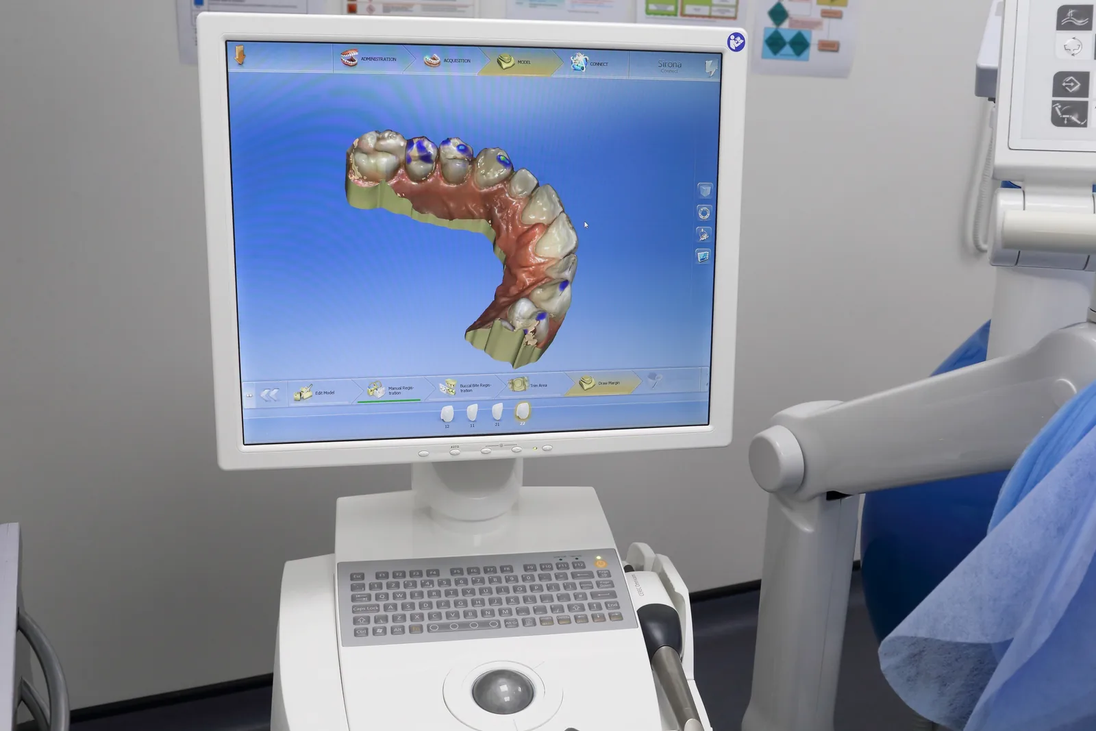 Ekran diagnostyczny z obrazem 3D używany przy planowaniu leczenia stomatologicznego